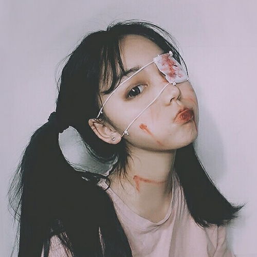 独眼受伤妹子