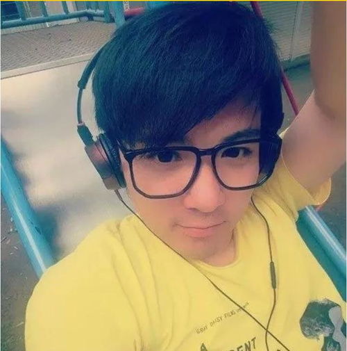 还记得三毛流浪记的三毛吗曾秃头挨300针植发,如今怎样