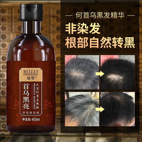 首乌洗发水男女去屑控油转黑神器纯植物白发转黑发增发密发洗发水