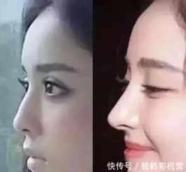 古力娜扎被质疑整容,鼻歪样子吓人,网友鼻子整成了匹诺曹