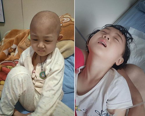 女童反复低烧确诊重病,单亲妈妈欲哭无泪,4个姐姐暖心卖粮救娃