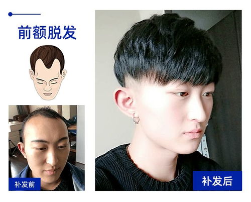 广州织发补发多少钱收藏价格表
