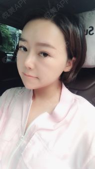 我现在也能算五官立体,轮廓清晰的美妈了吧我觉得女...注射除皱悦美整形
